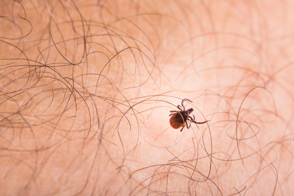 getting-lyme-disease