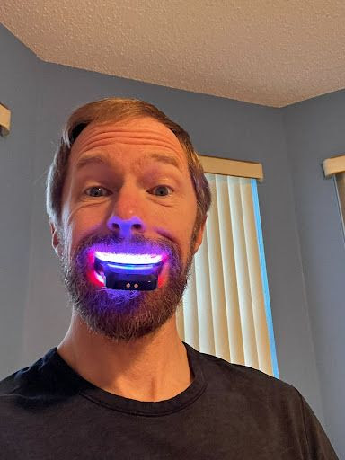Dr. Tom using the Primal Life Red & White Tooth Whitening System